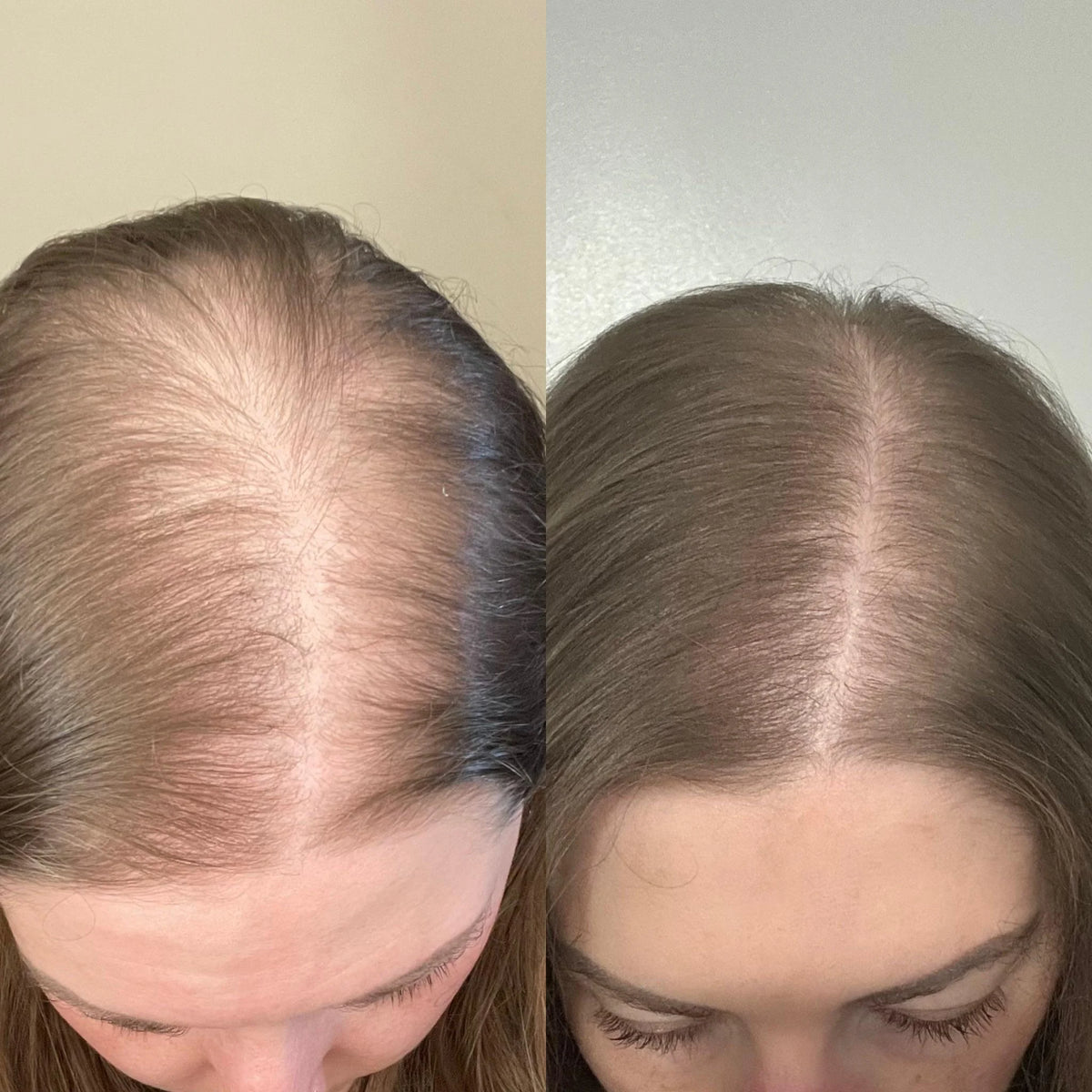 Bodywise™ - Hair Growth